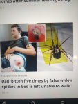 SPIDER BITES